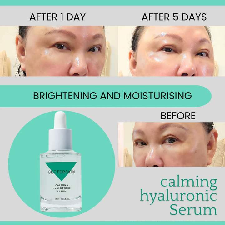 BETTERSKIN CALMING HYALURONIC SERUM - Image 4