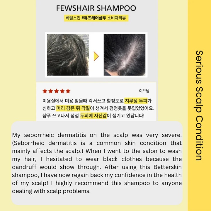 Scalp Care Anti Loss Hair Shampoo 7