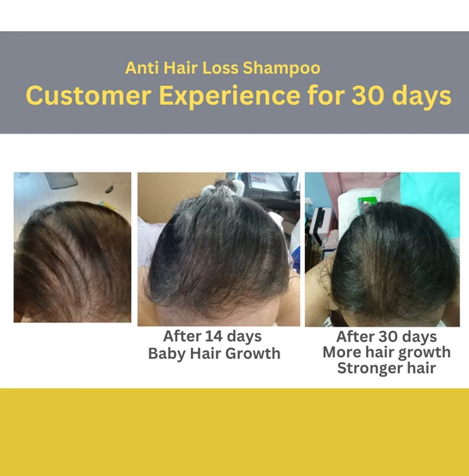 VCARE SCALP CARE ANTI HAIRLOSS SHAMPOO TRAVEL PACK - Image 7