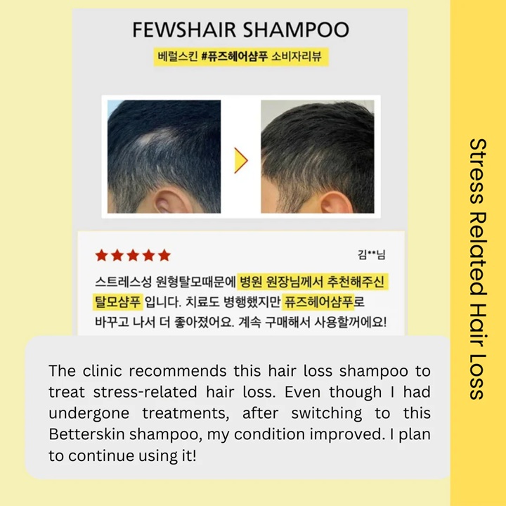 Vcare_Anti Hair Loss Shampoo Travel Pack 9