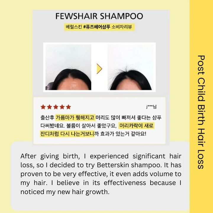 Vcare_Anti Hair Loss Shampoo Travel Pack 8