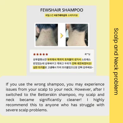 scalp_neck_problem